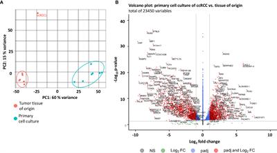 RNA Sequencing Reveals Alterations and Similarities in Cell Metabolism, Hypoxia and Immune Evasion in Primary Cell Cultures of Clear Cell Renal Cell Carcinoma